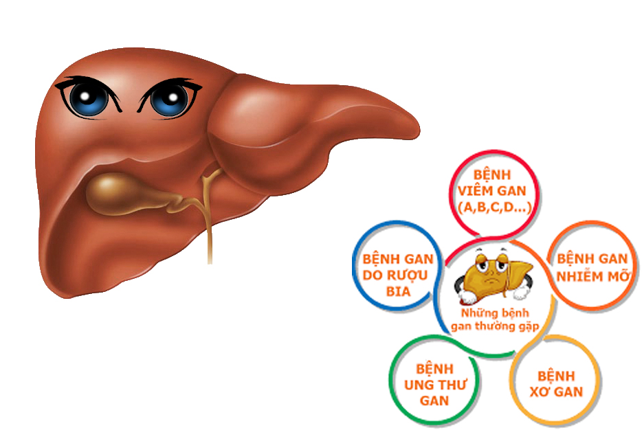 Những bệnh về gan phổ biến hiện nay thường mắc phải